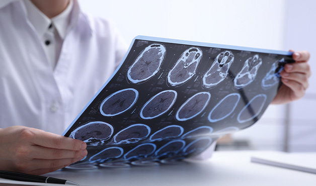 Interner link: Verlinkung zu Neurologie